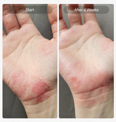 Tropicals Like Butter Moisturizer For Dry, Eczema-Prone Skin 50ml