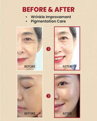 K-SECRET | SEOUL 1988 Serum : Retinal Liposome 2% + Black Gingeng, 30ml/1.01fl.oz | 58% Black Gingeng Extract with Retinal, Bakuchiol, Vitamin C & 3 Peptides Serum for Wrinkle Care | Korean Skincare |