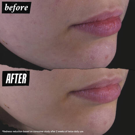 kiehls Calendula Herbal-Extract Toner