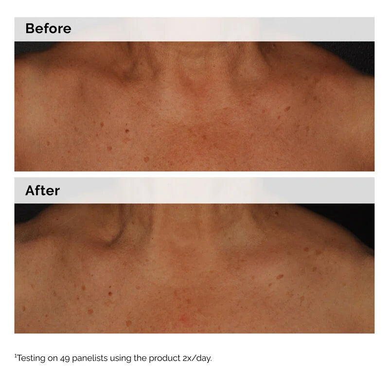 The Ordinary Niacinamide 5% Face and Body Emulsion 100ml