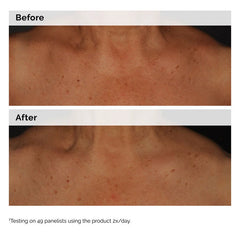 The Ordinary Niacinamide 5% Face and Body Emulsion 100ml