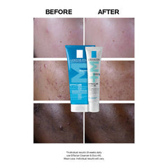 LA ROCHE POSAY Effaclar Duo+M Anti Imperfections Moisturiser 40ml