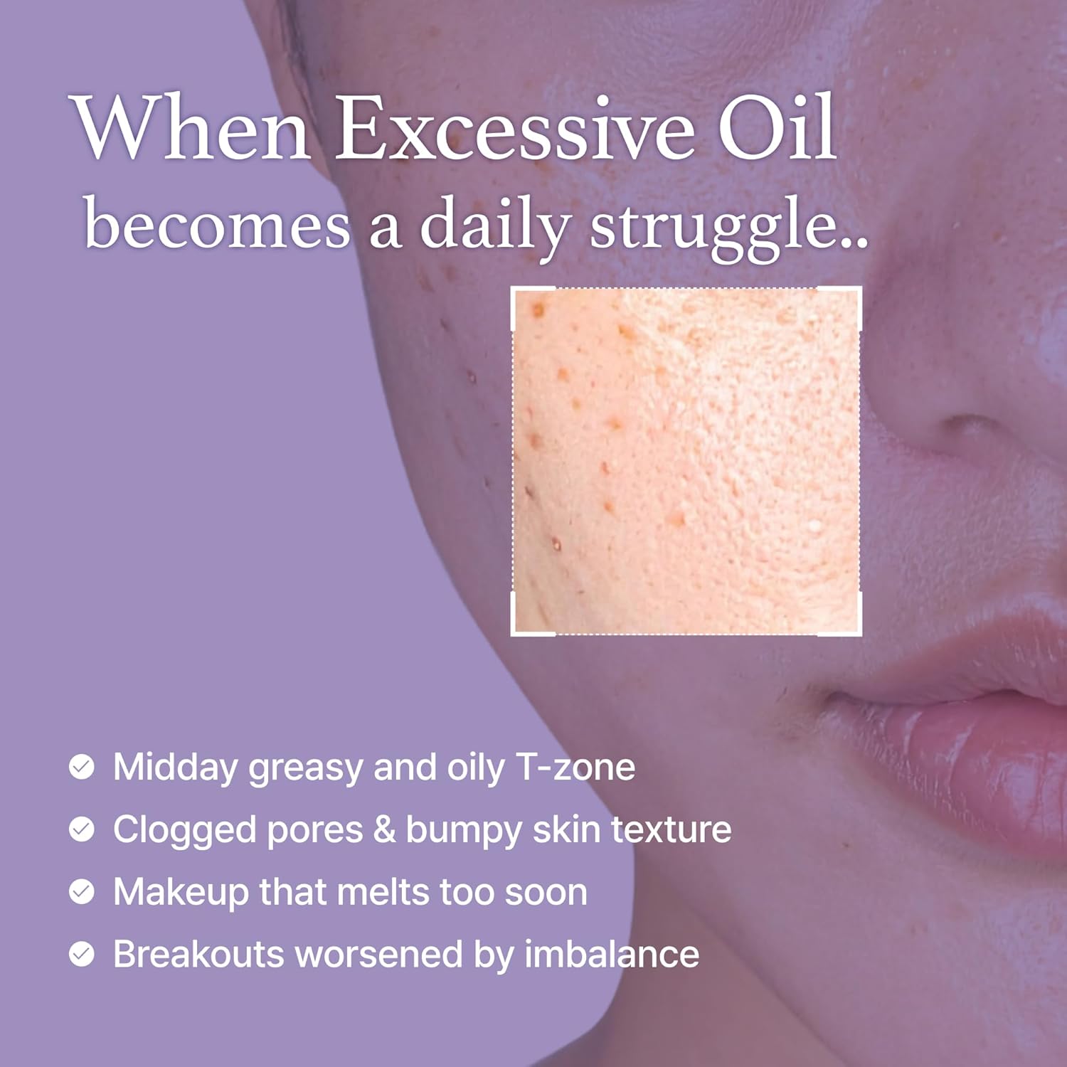 I’m from Black Rice Toner 150ml