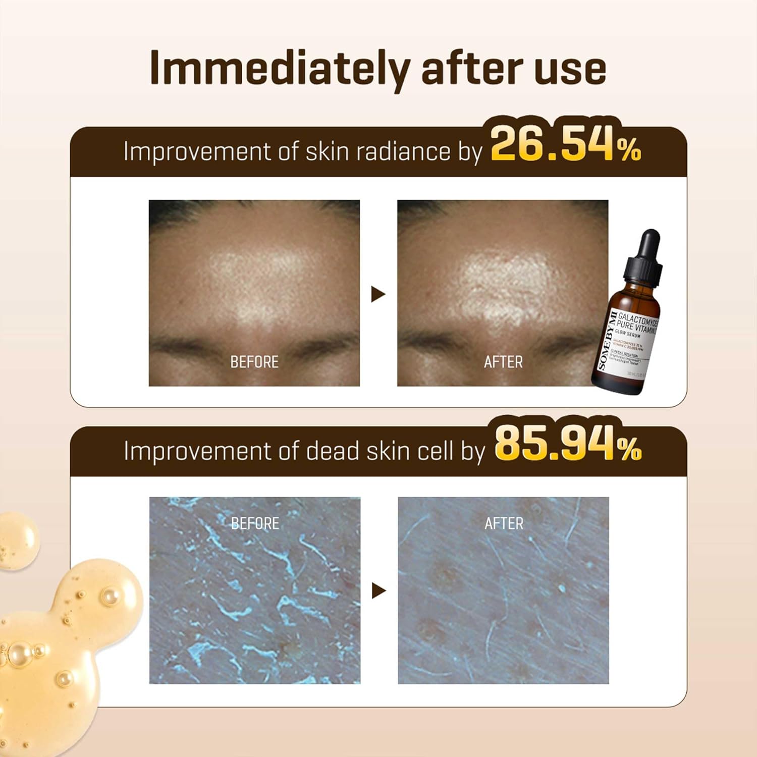 SOME BY MI Galactomyces Pure Vitamin C Glow Serum - 1.01Oz, 30ml - Korean Vitamin C Face Serum for Glow Glass Skin - Dark Spot Correcting Ampule with Brightening and Elasticity Care - Korean Skin Care