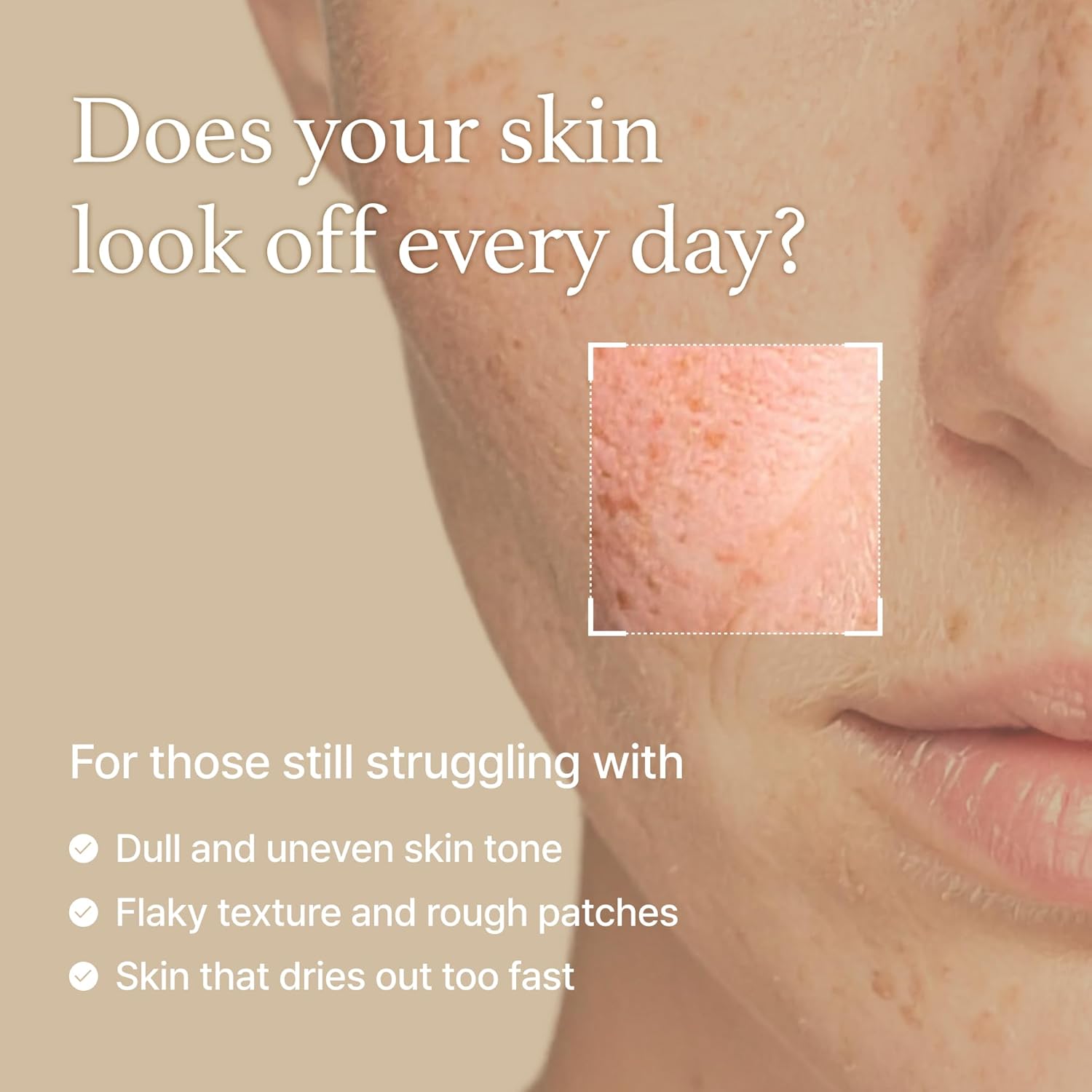 I'm From Rice Toner 150ml