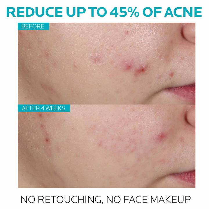 LA ROCHE POSAY Effaclar Salicylic Acid Serum 30ml