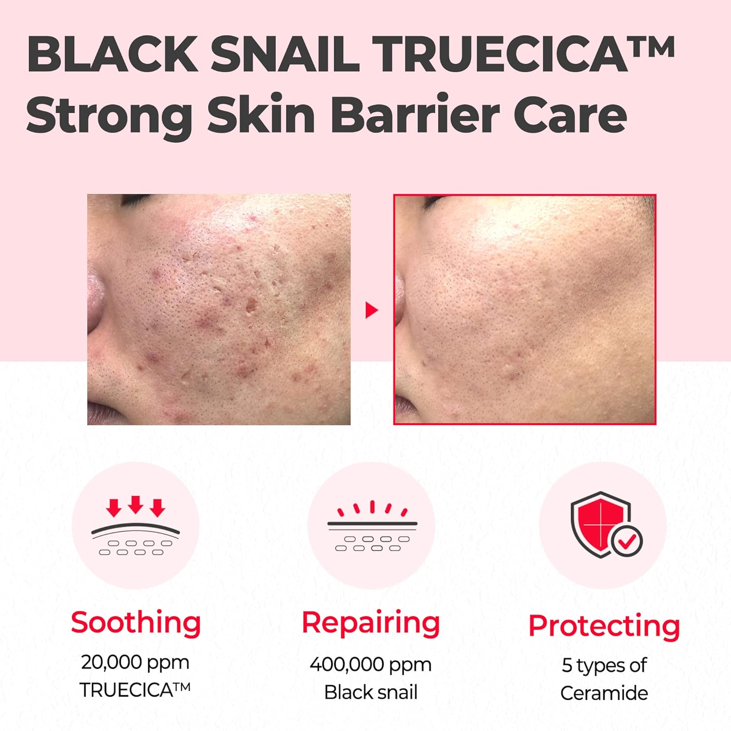 SOME BY MI Snail Truecica Miracle Repair Cream - 2.02Oz, 60ml - Made from Snail Mucin for Sensitive Skin - Daily Repair Face Moisturizer for Acne Marks and Strengthen Skin Barrier - Korean Skin Care