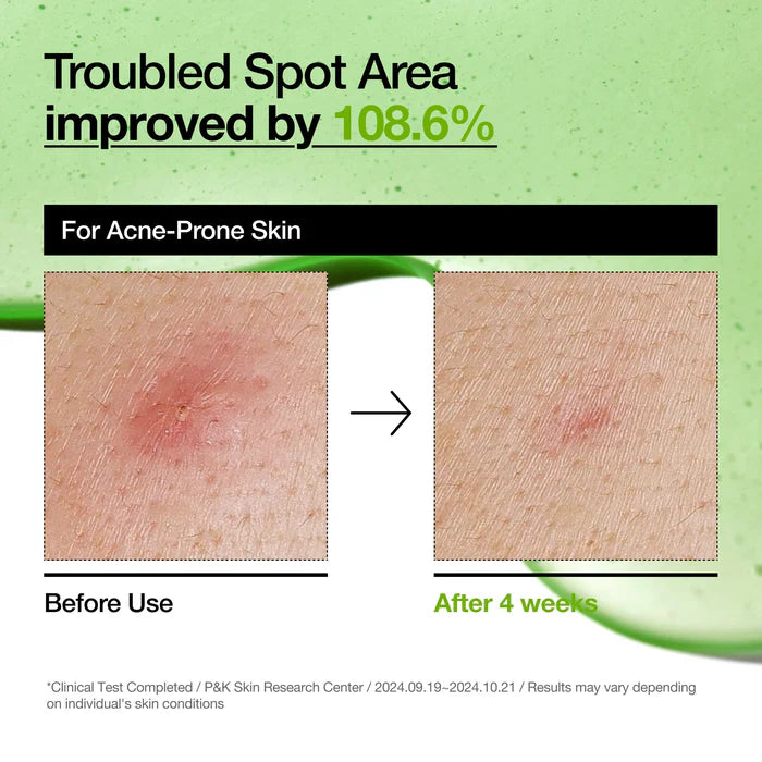 ANUA Azelaic Acid 10+ Hyaluron Redness Soothing Serum 30ml