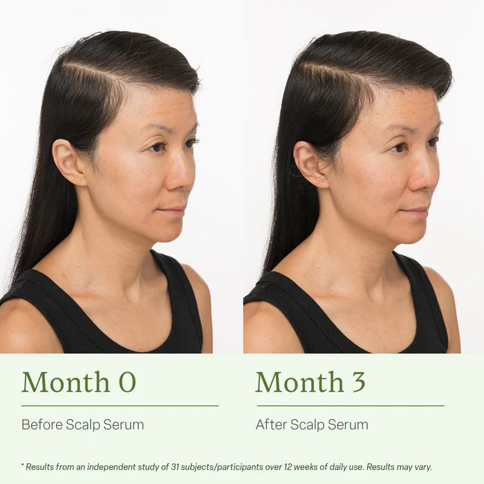 DIVI Revitalize And Detoxify Your Scalp With Divi Scalp Serum - Aids Against Hair-Thinning, Nourishes Hair Follicles, And Removes Product Build-Up 30ml