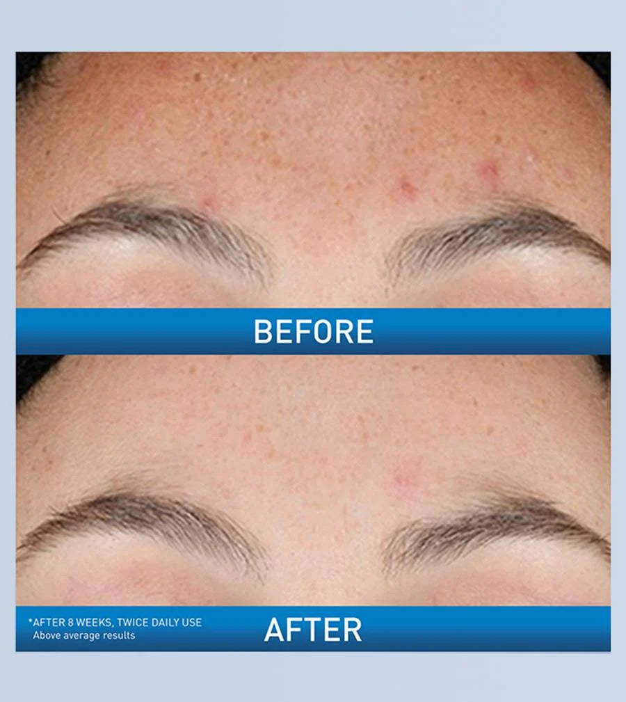 CeraVe Resurfacing Retinol Serum 30 ML