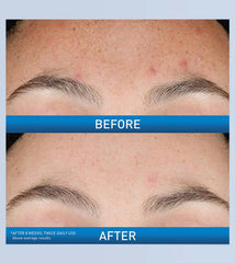 CeraVe Resurfacing Retinol Serum 30 ML