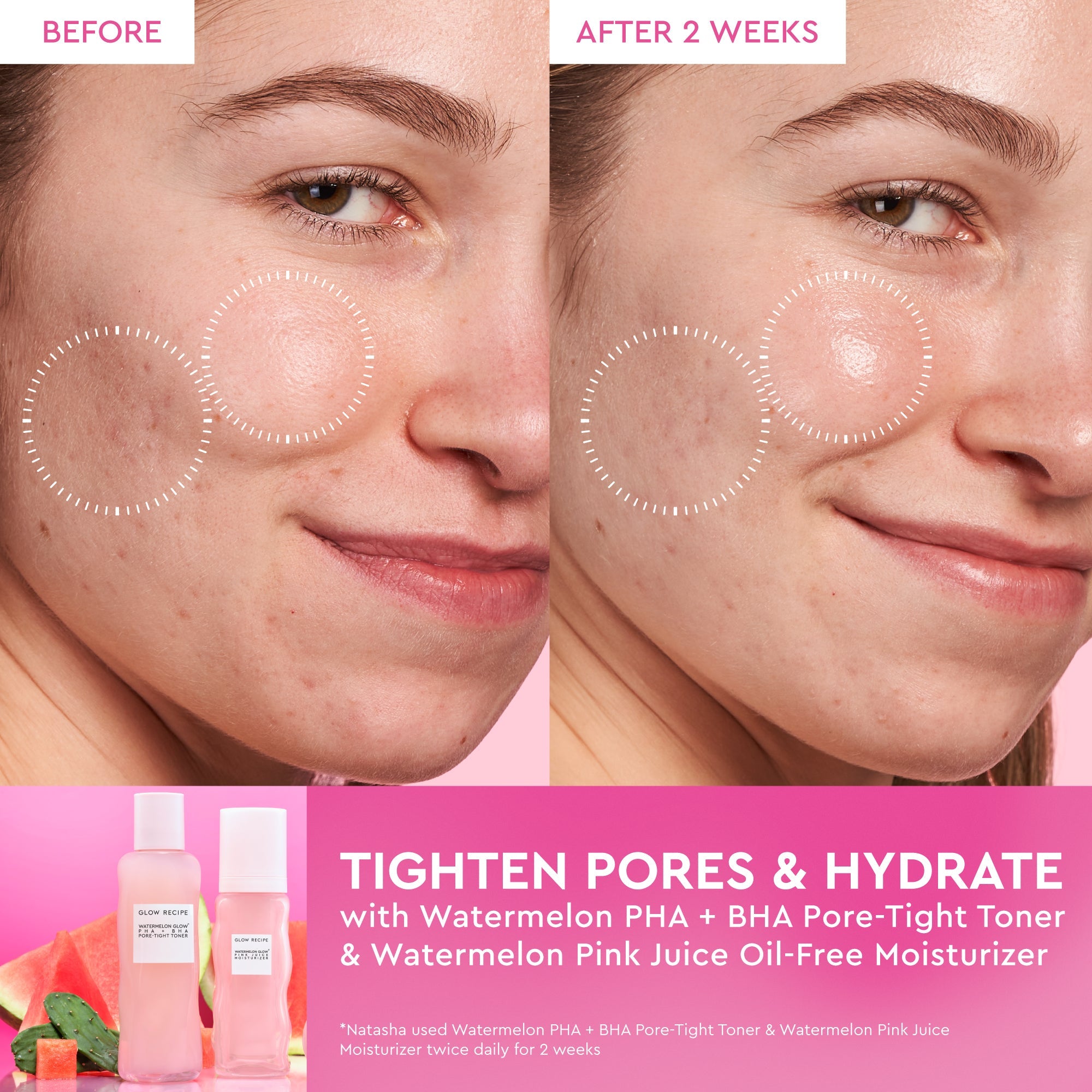 GLOW RECIPE Watermelon Glow PHA+BHA Pore-Tight Toner 150ml