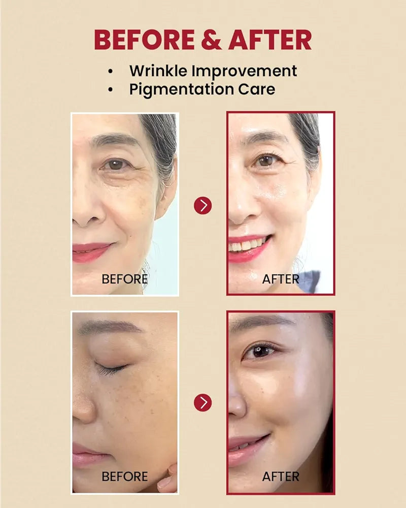 K-SECRET | SEOUL 1988 Serum : Retinal Liposome 2% + Black Gingeng, 30ml/1.01fl.oz | 58% Black Gingeng Extract with Retinal, Bakuchiol, Vitamin C & 3 Peptides Serum for Wrinkle Care | Korean Skincare |