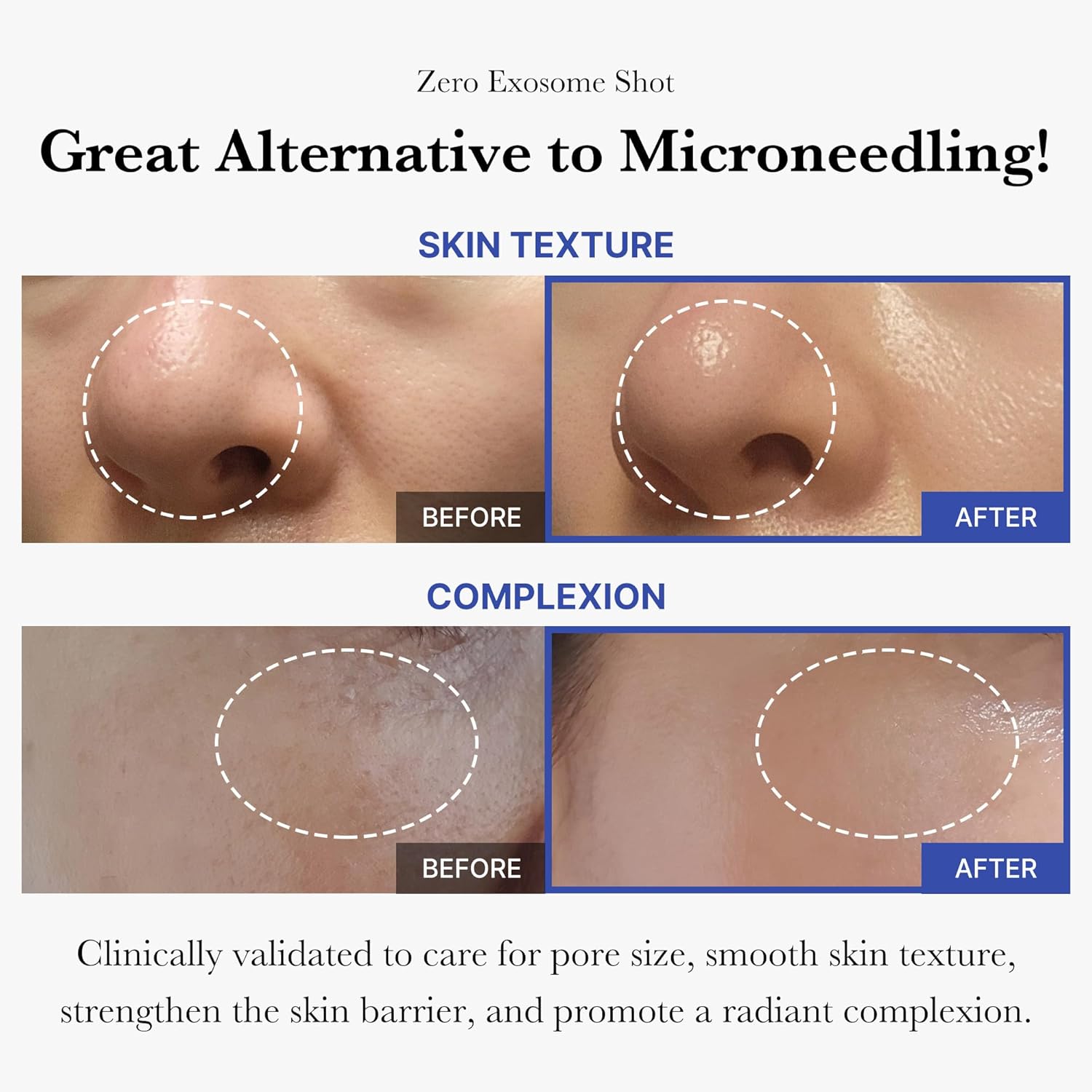 Medicube Zero Exosome Shot 7,500 PPM Spicule Facial Serum 30ml