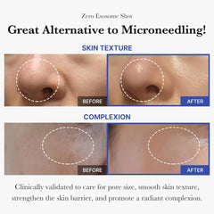 Medicube Zero Exosome Shot 7,500 PPM Spicule Facial Serum 30ml