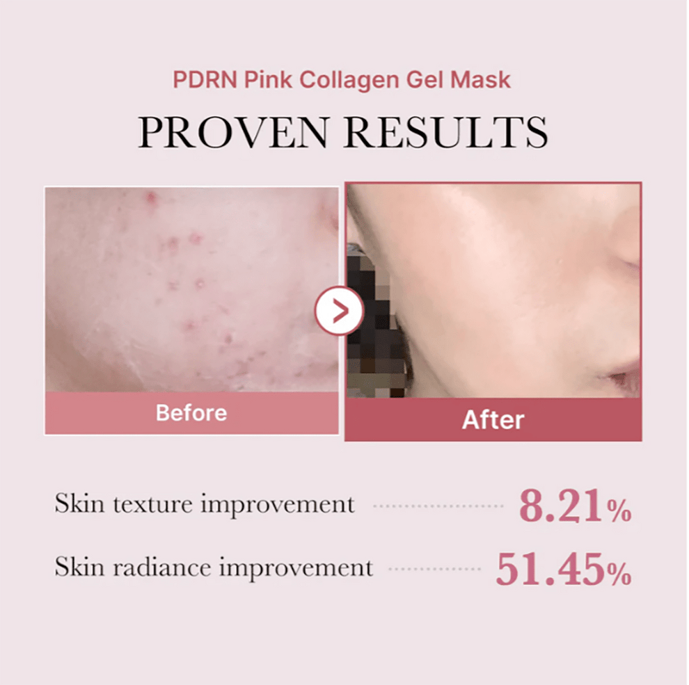 Medicube PDRN Pink Collagen Jelly Gel Face Sheet Mask ( 4/Sheets Box )